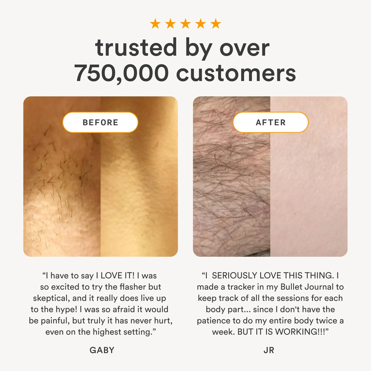 Nood The Flasher 2.0 IPL Laser Light Hair Removal Tool